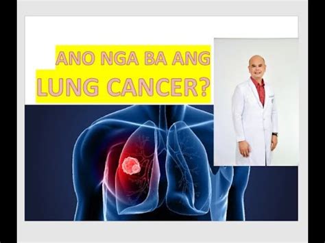Nakakahawa ba ang lung cancer